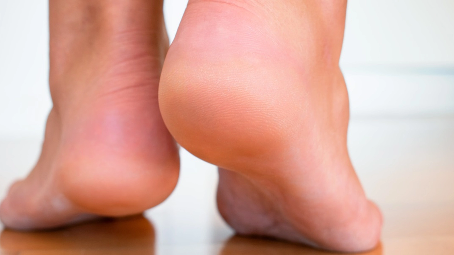 Lei av tørre hæler? Den enkle og effektive løsningen finner du på kjøkkenet ditt