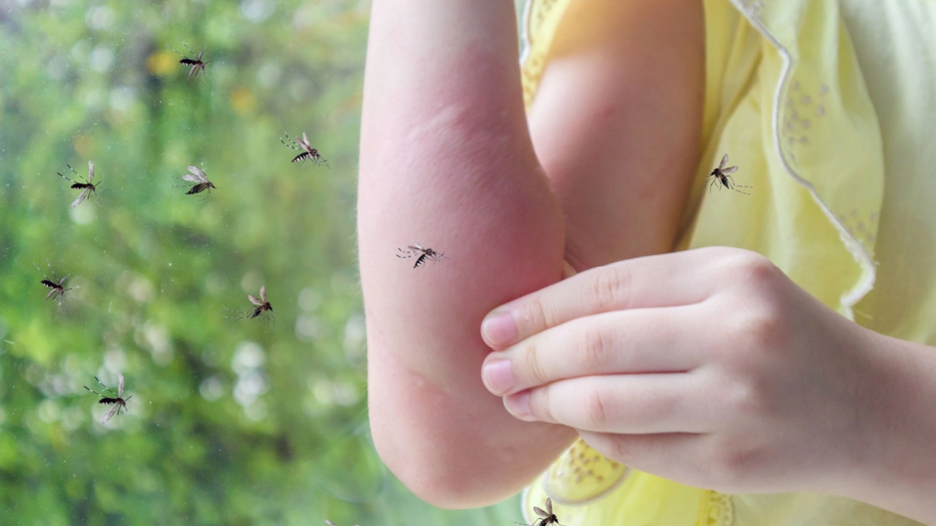 Nesten ingen skjønner det: Her er grunnen til at du er en myggmagnet