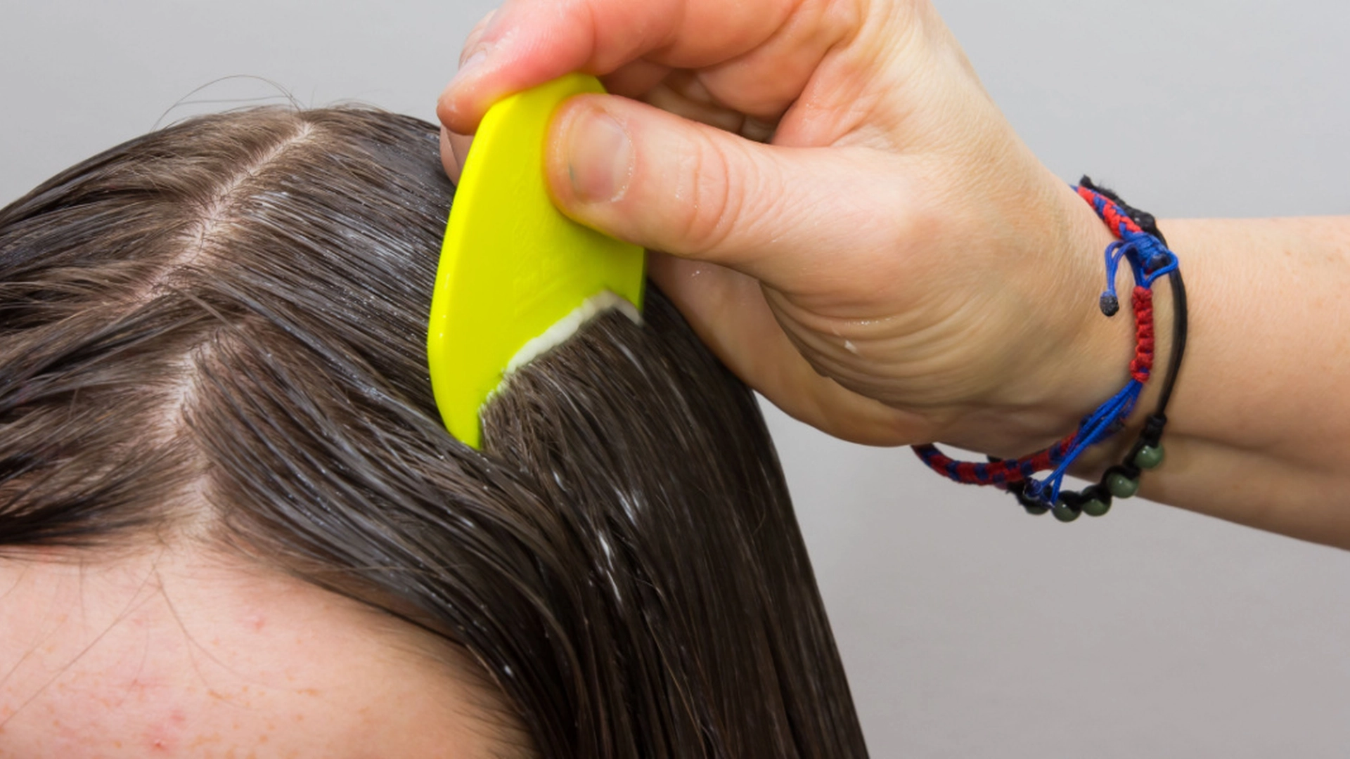 Mor nekter å drepe barnets hodelus: Du vil aldri gjette hvorfor