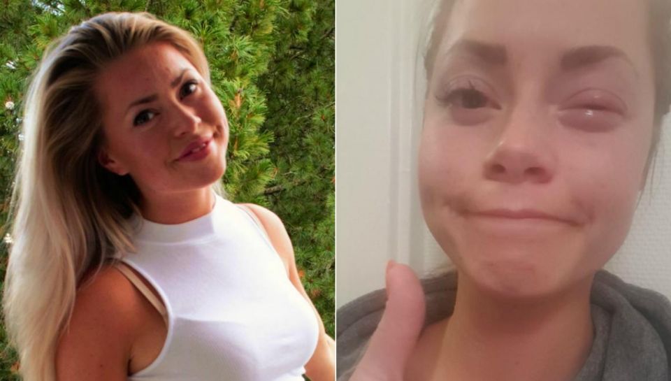 Angelica skulle bare ta øyendråpene sine: Så skjedde det værst tenkelige