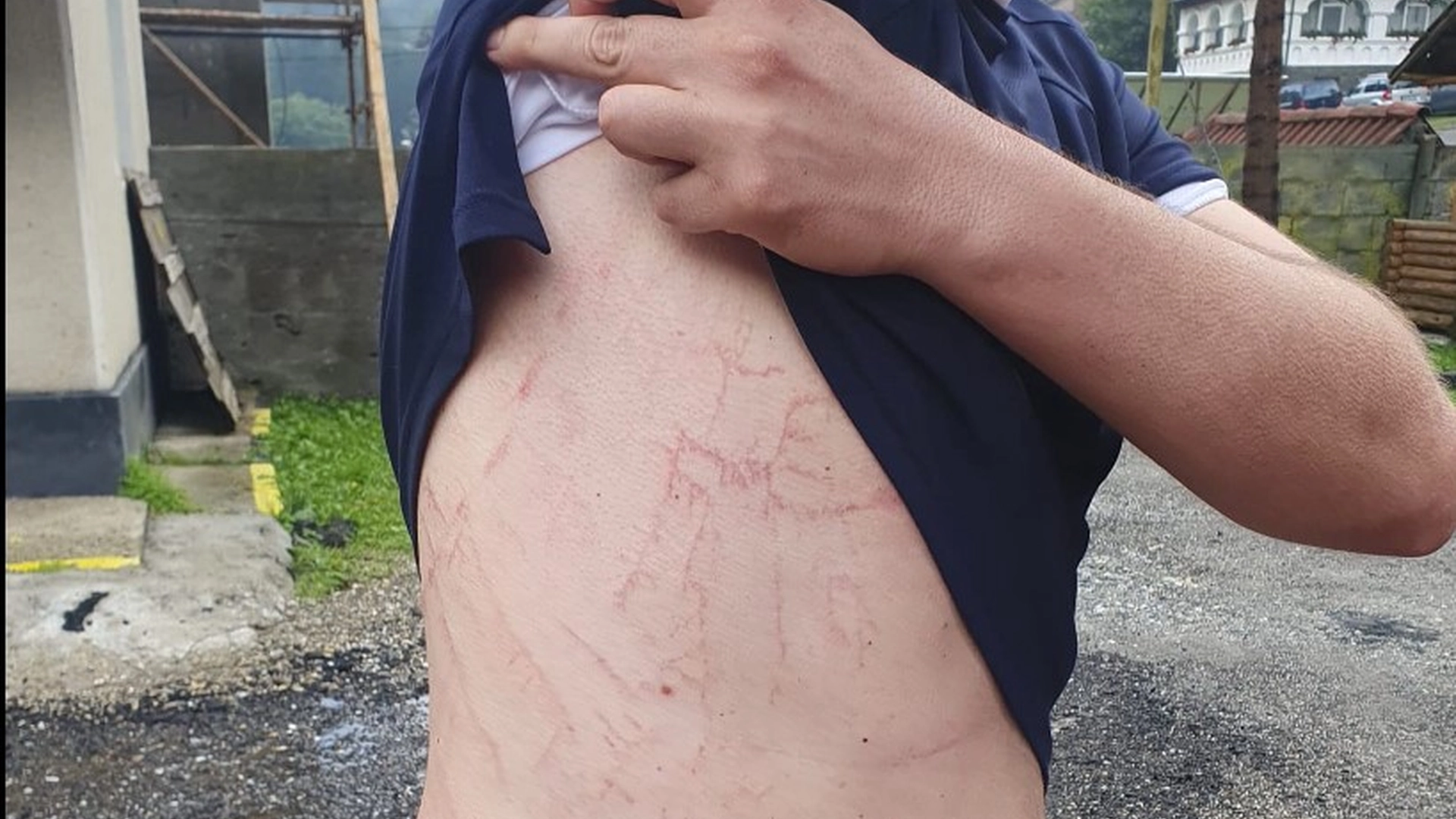 Mann overlever lynnedslag: Nå deler han råd til andre turgåere