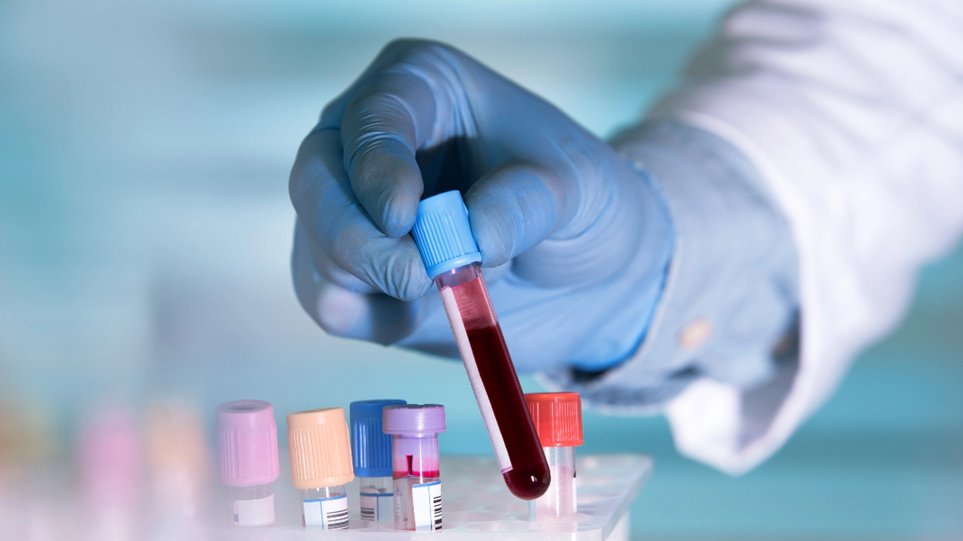 Kinesiske forskere oppdager ny soppinfeksjon hos mennesker