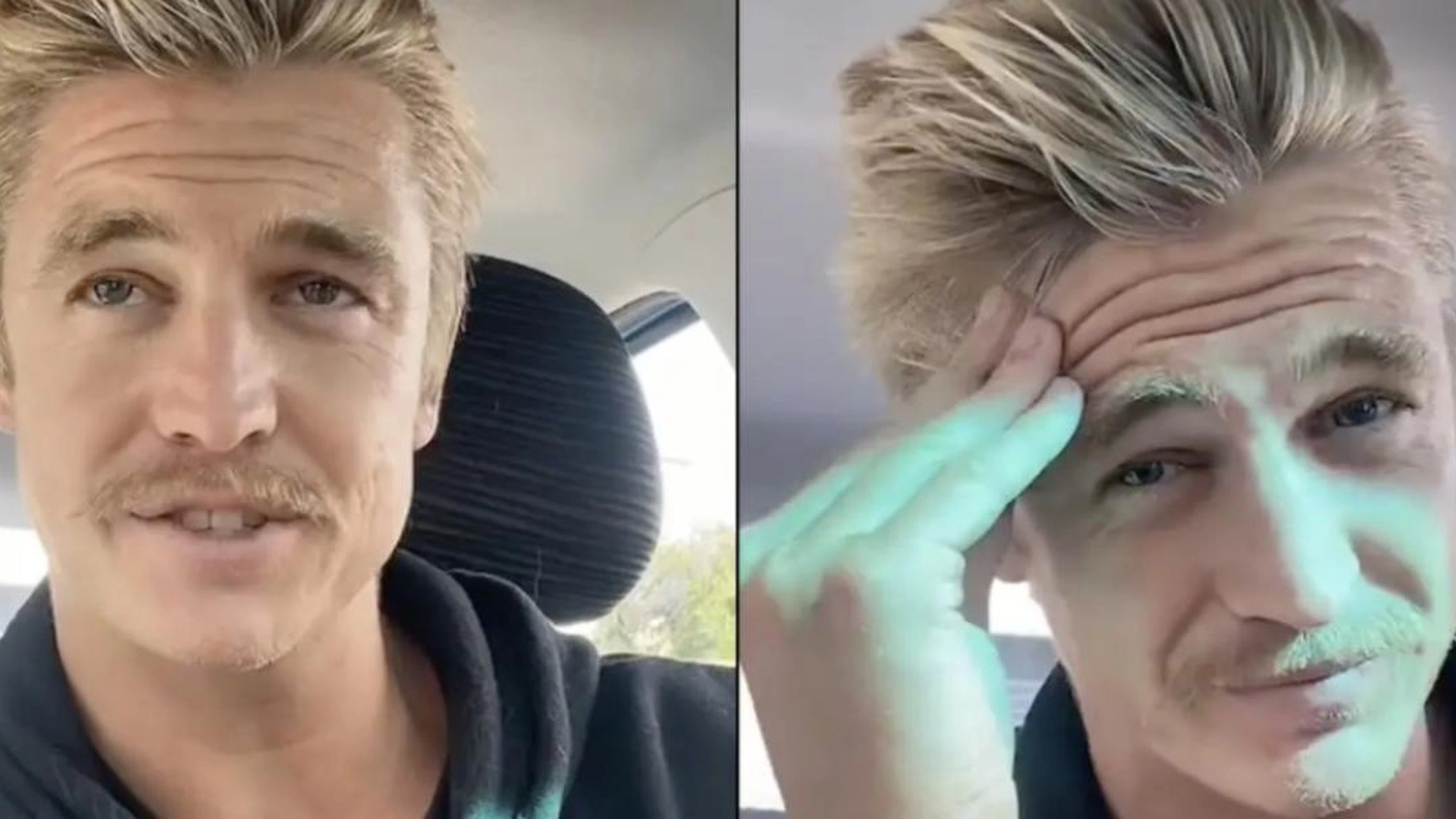 Nick har ikke vasket håret på 6 år: Slik ser det ut