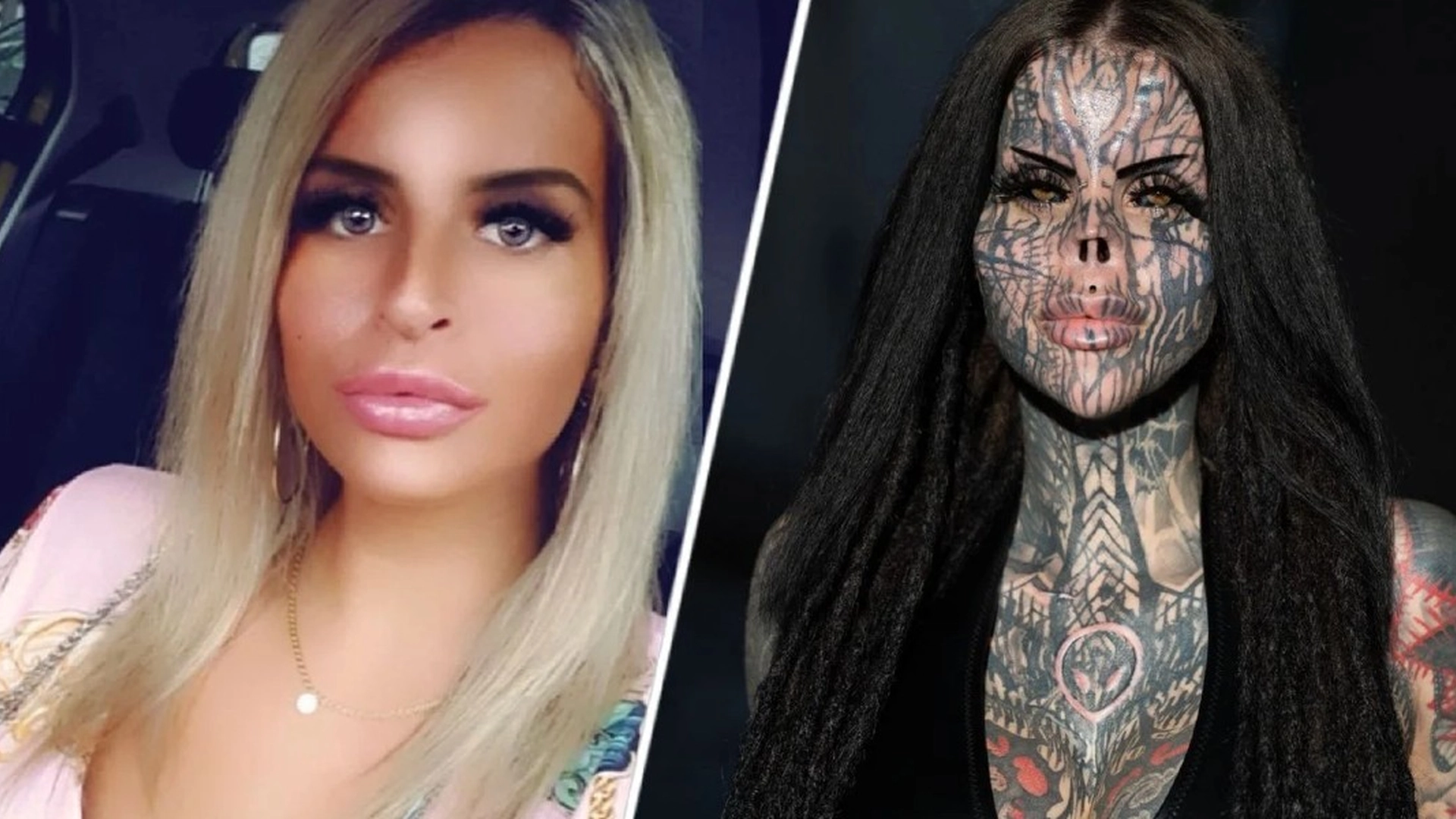 Danielle har fått amputert nesen: «Nå er jeg intenst glad»
