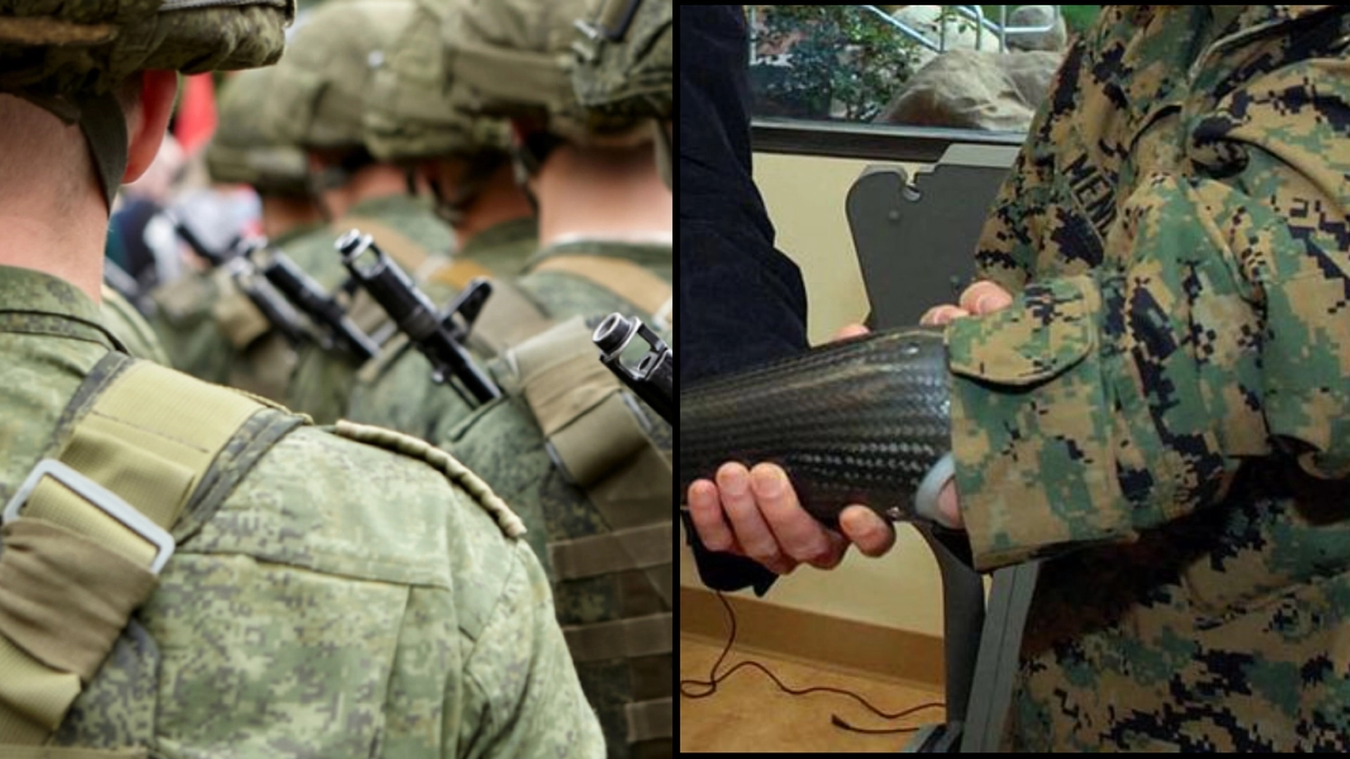 Russisk soldat lovet armprotese: Får ydmykende alternativ i stedet