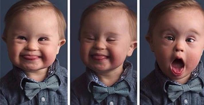 Liten gutt med Downs syndrom var ikke pen nok for reklamebyrået: Så gjør moren noe som forvandler sønnen til en helt på nettet