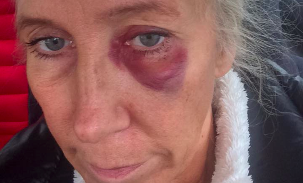 Katarina stoppet brutalt voldtektsforsøk – nå hylles hun av tusener