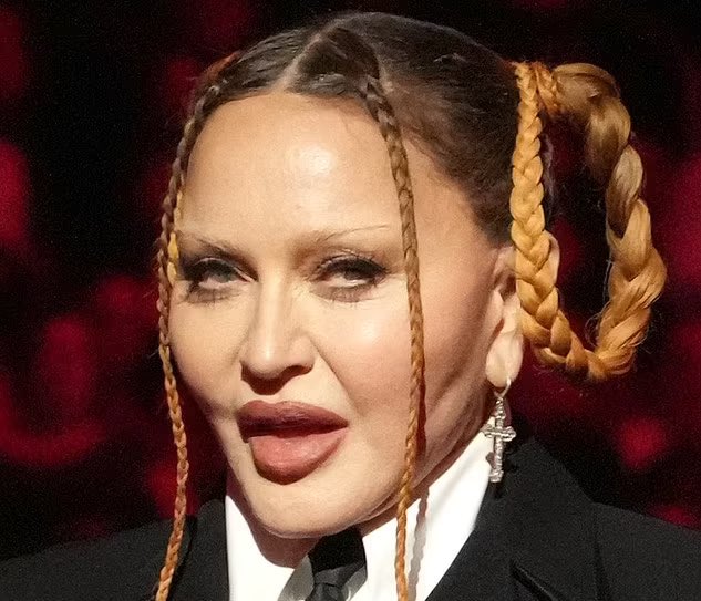 Madonna: Svarer på kritikk om ansiktet hennes