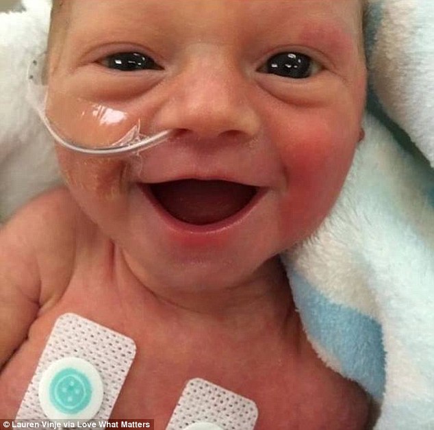For tidlig født baby smiler bare fem dager gammel