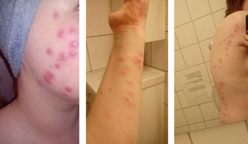 25-årige Ida fikk tilbud om fint rom i kollektiv: Første morgenen våknet hun til et skremmende syn