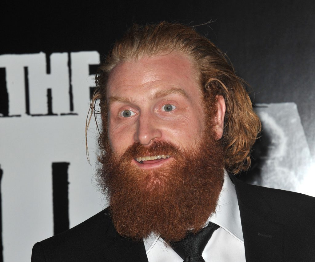 Kristofer Hivju endret utseende: Ikke til å kjenne igjen