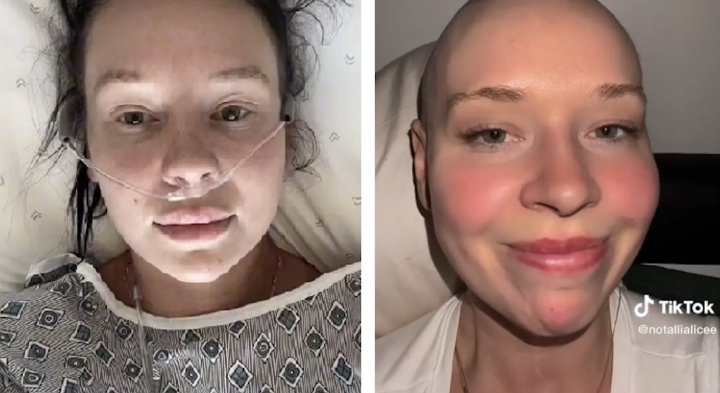 Skuespiller går viralt: Er hun verdens mest uheldige kvinne?