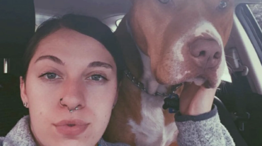 Pitbull bet av kvinnens nese: Nå vokser håret ut på hennes nye nese