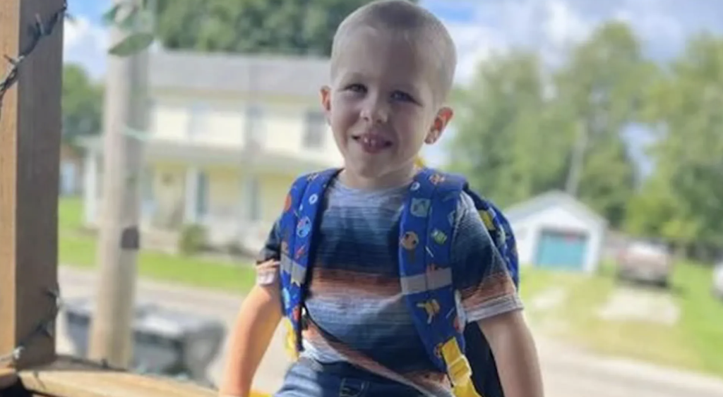 3 år gammel gutt fikk nesten armen revet av