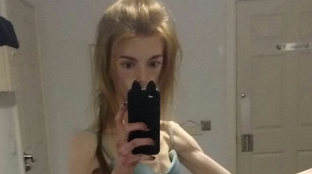 Annie spiste bare en brødskive om dagen i 5 år: Se henne nå