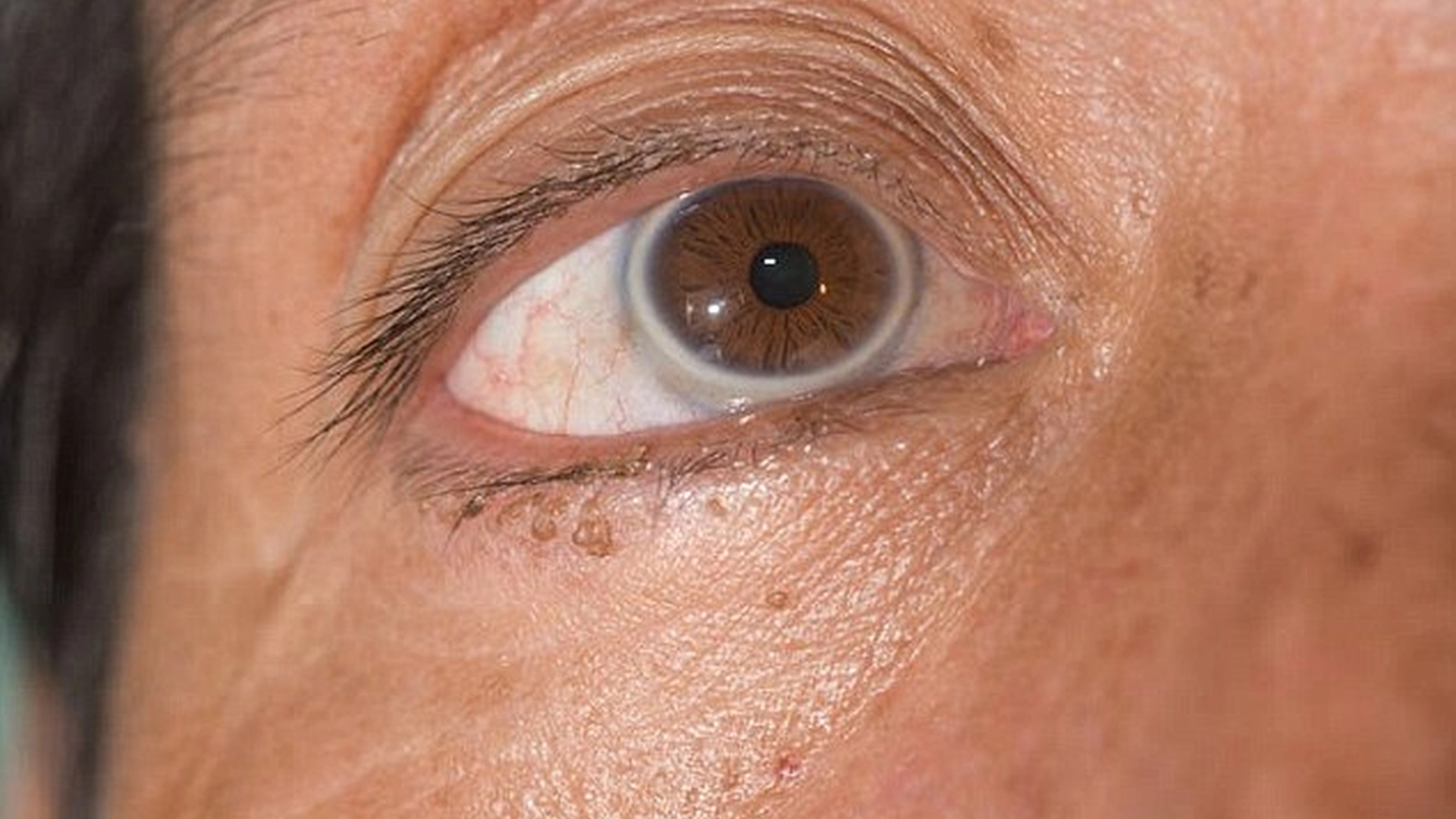 6 uvanlige tegn på at du har skjult hjertesykdom