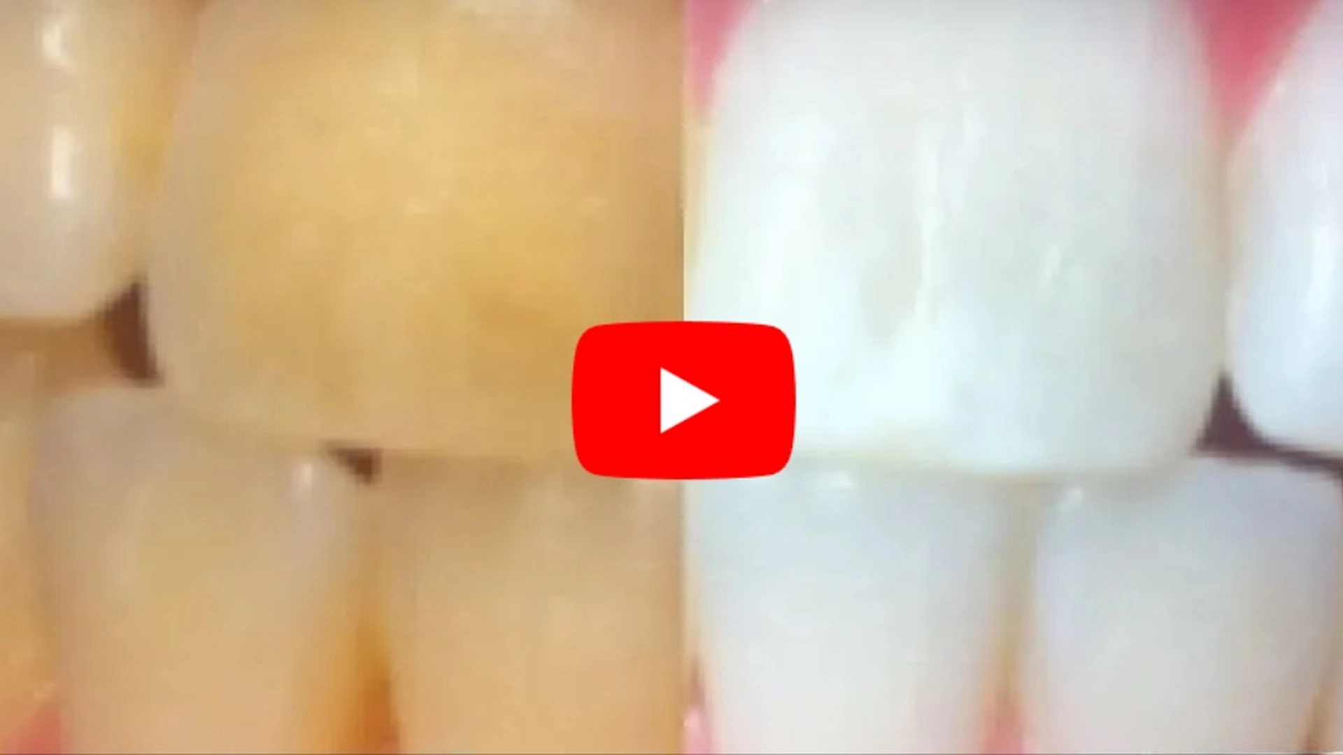 Enkelt og billig triks: Slik får du HELT hvite tenner på 3 minutter