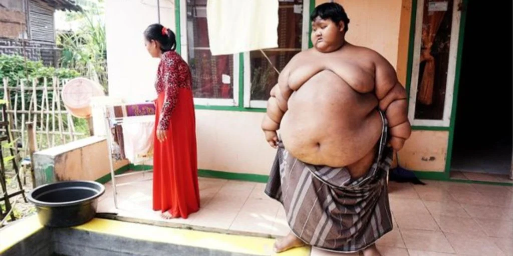 Han var verdens tykkeste barn som 9-åring og veide 190 kilo: I dag er han ugjenkjennelig