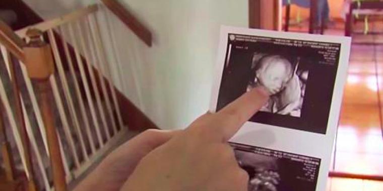 Mor til trillinger blir gravid igjen: Når hun ser bildet, orker hun ikke situasjonen