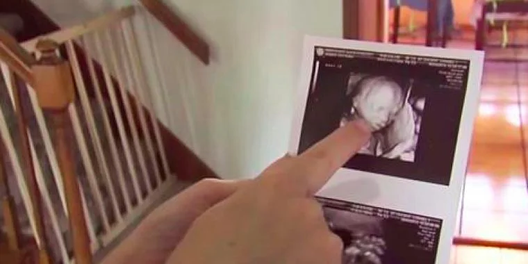 Mor til trillinger blir gravid igjen: Når hun ser bildet, orker hun ikke situasjonen