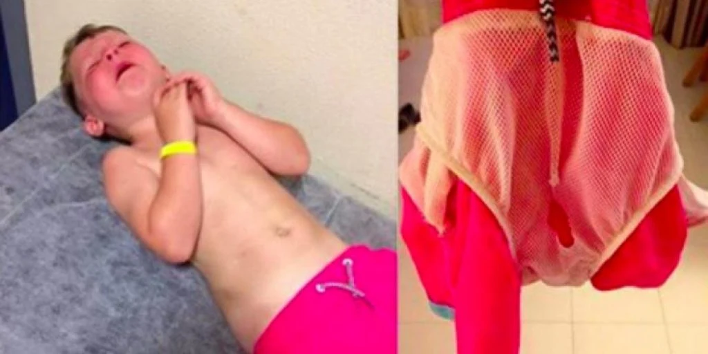 5 år gamle Jack skrek på stranden – da Laura tok av han badebuksa, ble hun forferdet