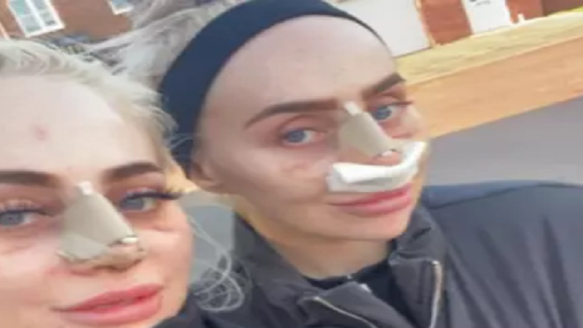 Tvillinger har brukt 1,8 millioner kroner for å se ut som Barbie: Slik ser de ut i dag