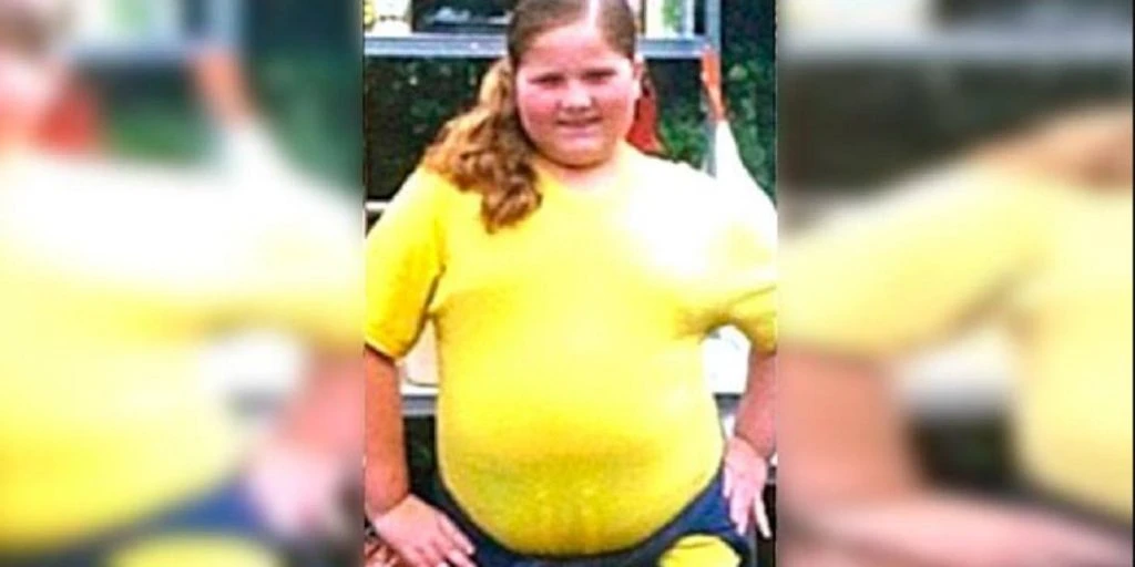 Som 9-åring veide hun 85 kilo: Et år senere er hun ugjenkjennelig