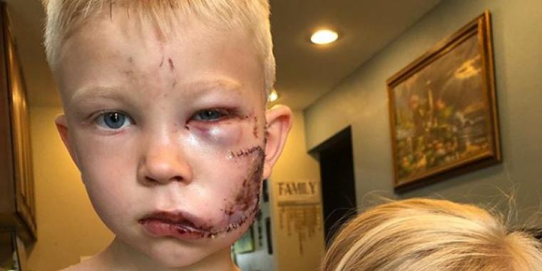 6 år gammel gutt reddet lillesøster: «Hvis det var noen som skulle dø, skulle det vært meg»