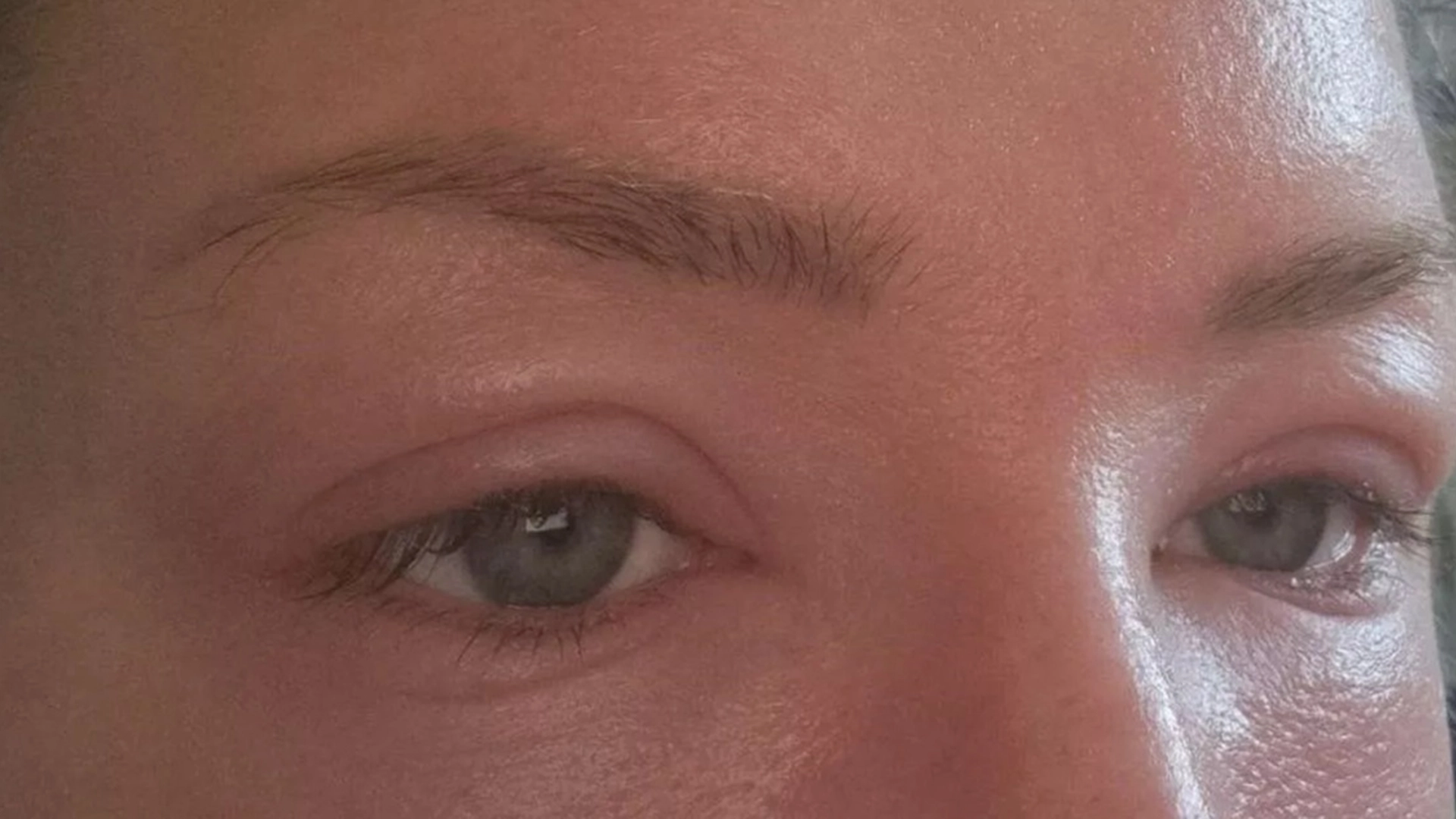 Hun brukte ofte akrylnegler – en overraskende beskjed fra legen fikk henne til å droppe dem
