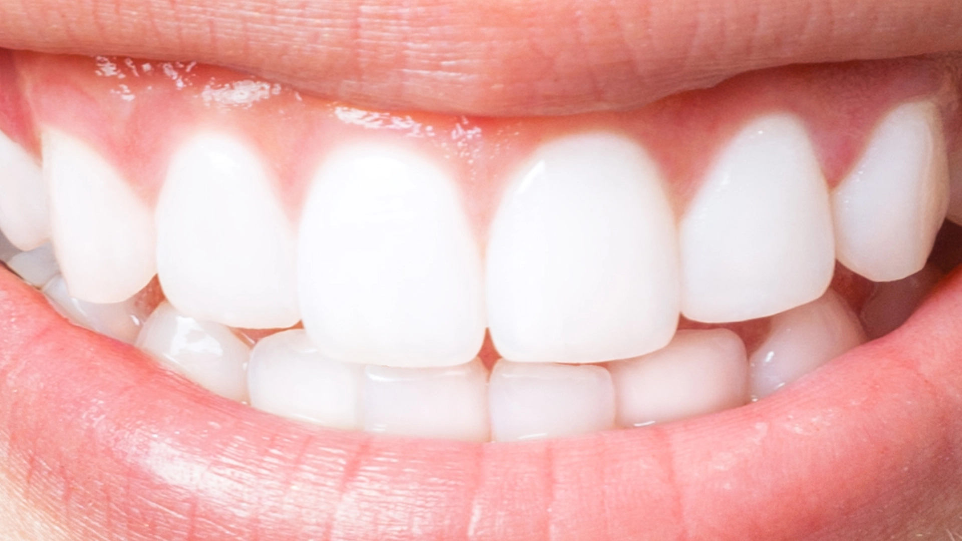 Hvordan bleke tennene med naturlige ting du har hjemme