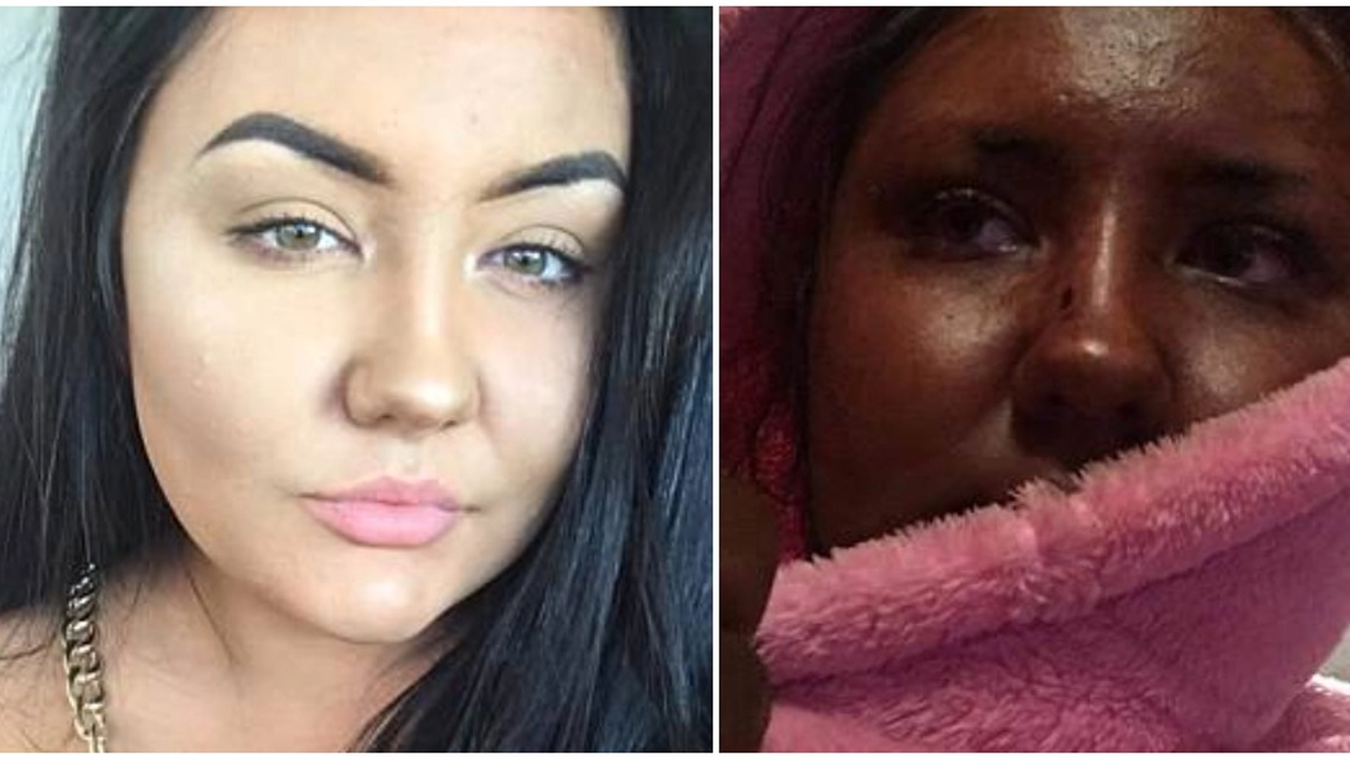 20 år gammel kvinne prøvde ny selvbruning: Nå ler alle av henne