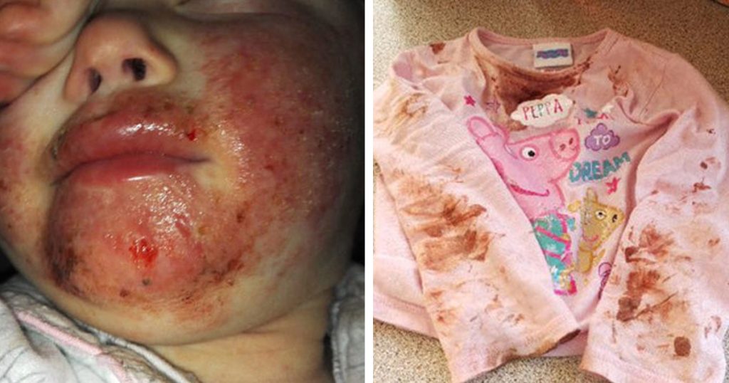 Jente løper inn til moren sin med ansiktet innsmurt i blod – så husker moren hva som skjedde for 8 måneder siden