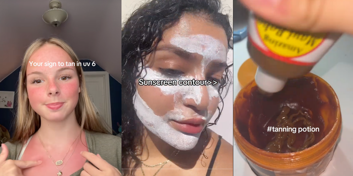 Denne nye soltrenden sjokkerer leger: Som å be om hudkreft