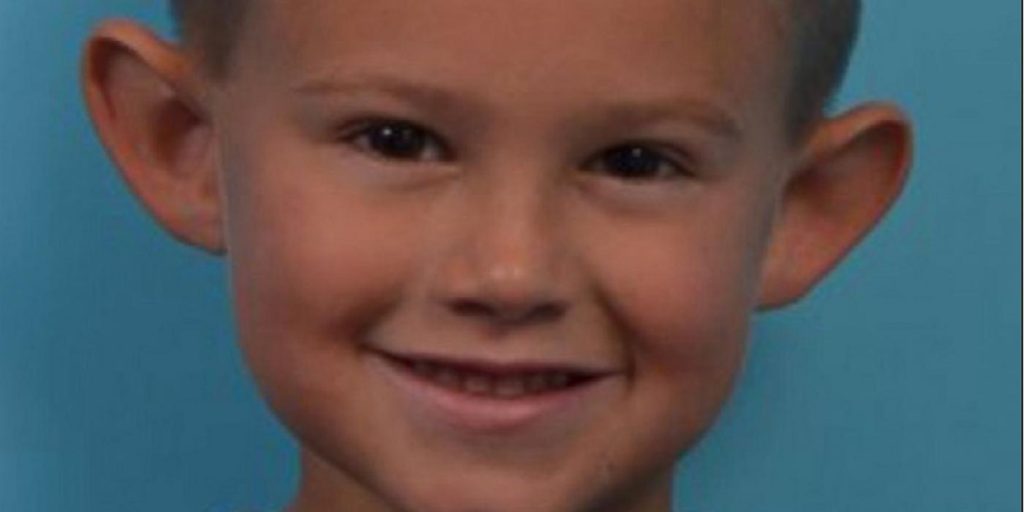 6-åringen ble mobbet og kalt ‘Dumbo’ av klassekameratene: I dag er han ugjenkjennelig