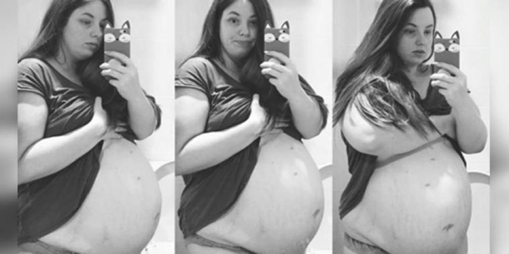 En 22 år gammel mor er gravid for fjerde gang – men så avslører legen detaljer i ultralydbilde