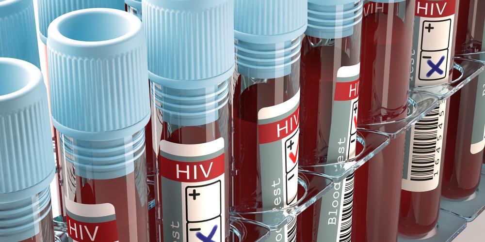 Nærmer seg en kur for AIDS: Kvinnens immunsystem har renset kroppen for virus