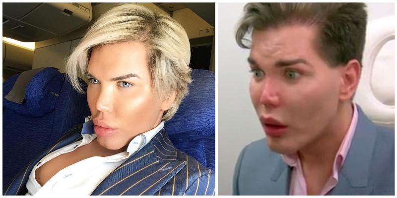 Wannabe ‘Ken-dukke’ har brukt tusenvis av kroner på å ligne på idolet sitt: Nå risikerer han å miste nesen
