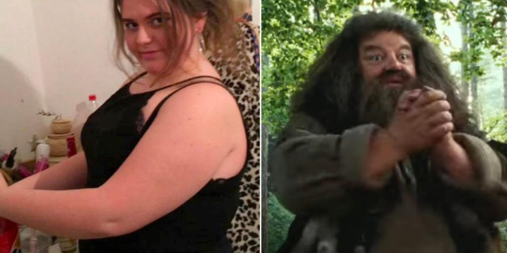 Hun ble mobbet for å se ut som Gygrid fra Harry Potter: I dag er hun ugjenkjennelig