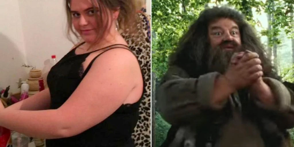 Hun ble mobbet for å se ut som Gygrid fra Harry Potter: I dag er hun ugjenkjennelig