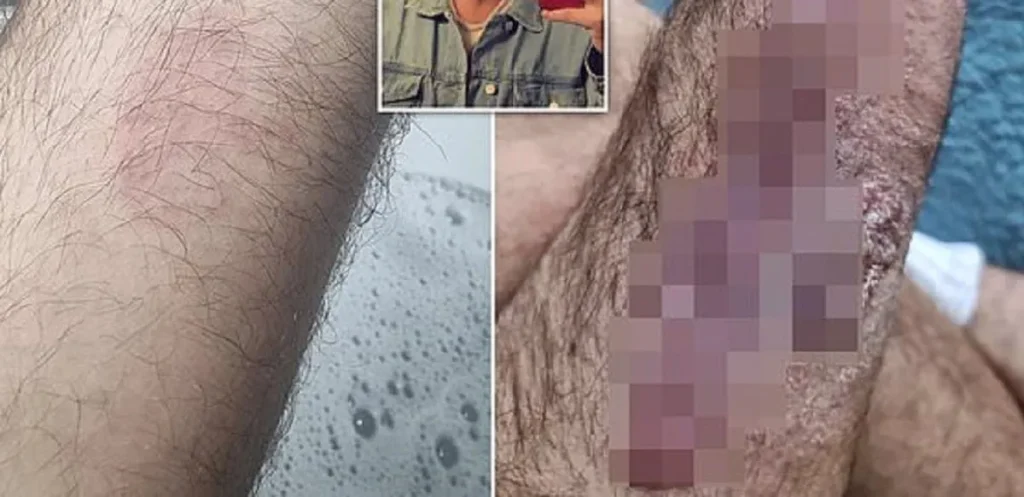Mann brukte spesiell sjampo: Nå advarer han andre