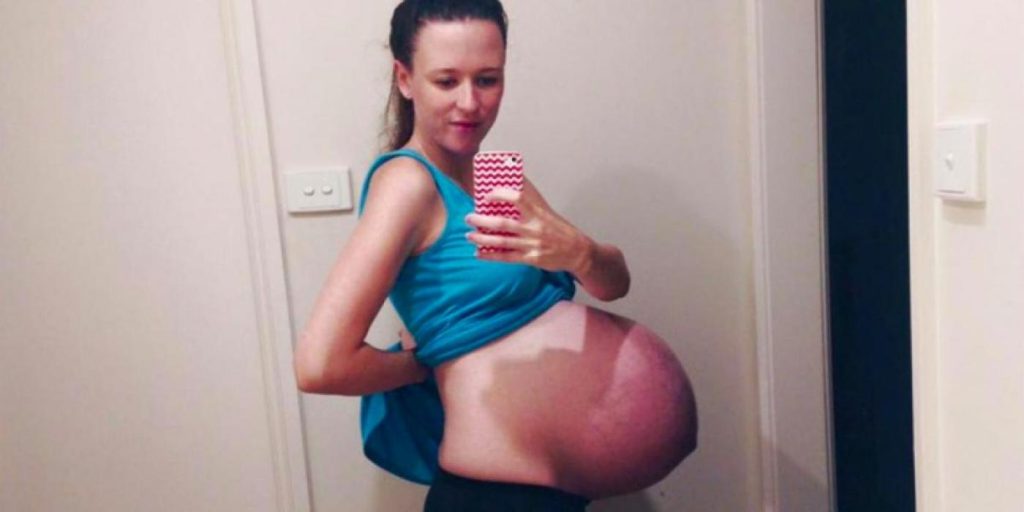 Meg advarer: Derfor bør du ikke legge ut bilder av den gravide mage din på Facebook