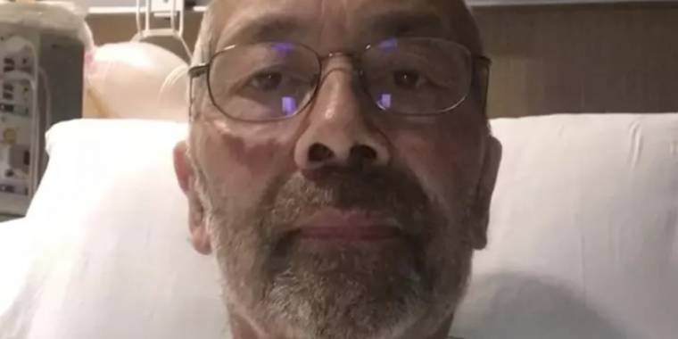 Michael ble innlagt på sykehus med koronavirus i 62 dager – Ble sendt hjem med gigantisk regning