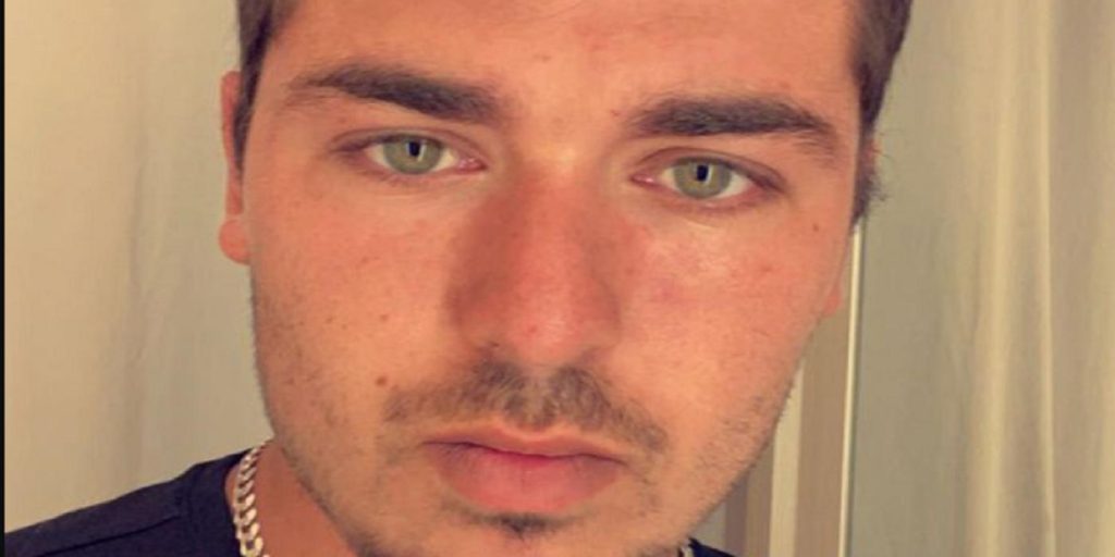Mike tok en lur: Når han våkner, kan han ikke se ut av det ene øyet