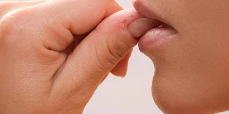 5 ubehagelige fakta: Dette er grunnen til at du bør slutte å bite negler