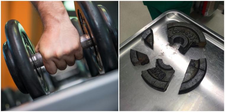 Mannens penis satt fast i håndvekt: Brannmenn måtte bruke 3 timer på å få den fri