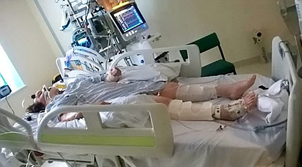 22 år gammel jente erklært hjernedød: Akkurat da legene slo av respiratoren, begynte moren til jenta å skrike