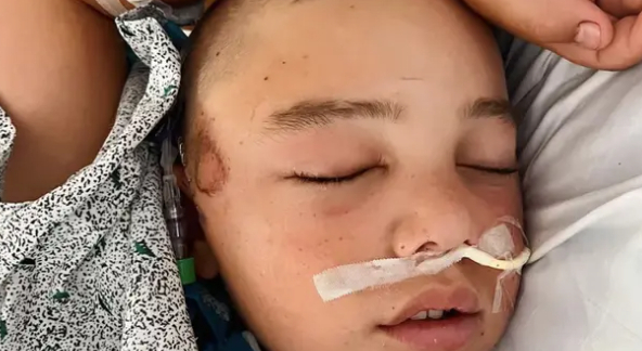 12 år gammel gutt var minutter fra å dø etter at han falt ned fra køyesengen