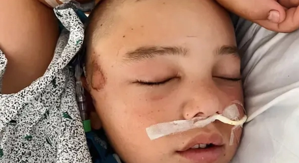 12 år gammel gutt var minutter fra å dø etter at han falt ned fra køyesengen