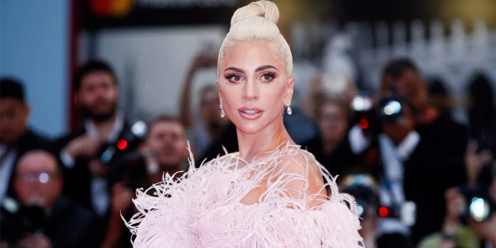 Lady Gaga deler oppsiktsvekkende bilde