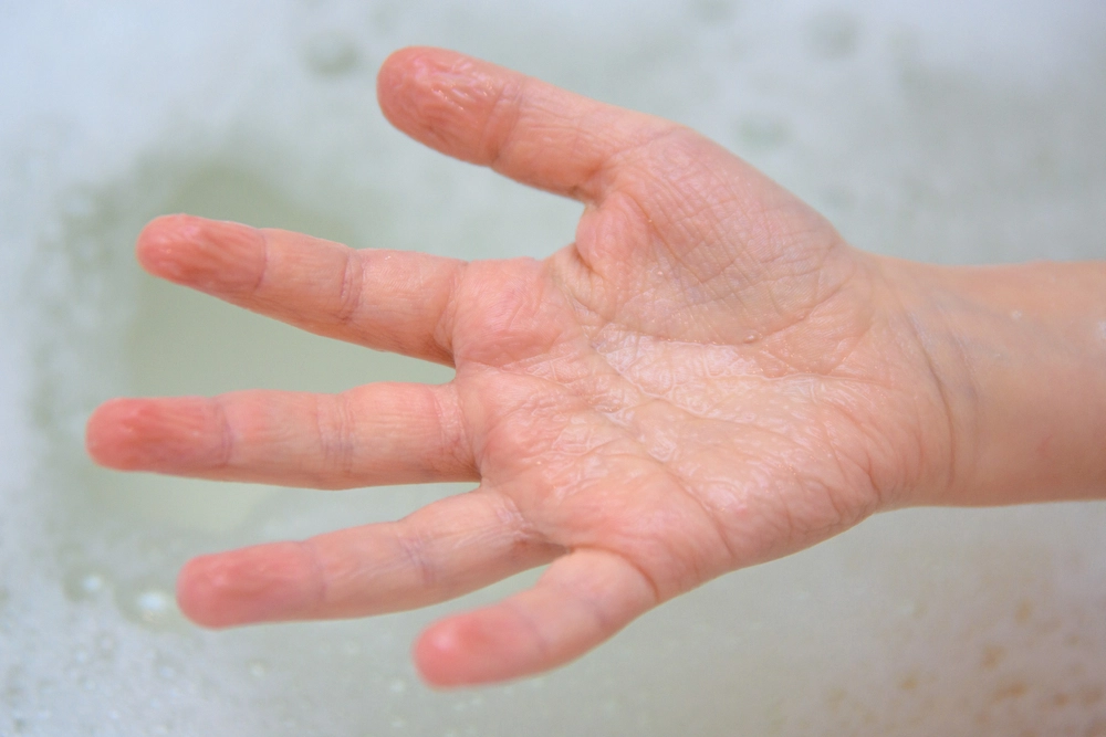 Du har trodd feil hele livet: Derfor blir fingrene skrukkete i vann